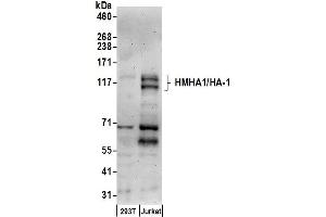 Western Blotting (WB) image for anti-Histocompatibility (Minor) HA-1 (HMHA1) (AA 100-150) antibody (ABIN7450332)