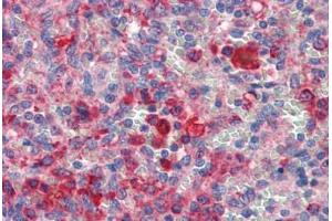 Human Spleen (formalin-fixed, paraffin-embedded) stained with GATA6 antibody ABIN462170 followed by biotinylated goat anti-rabbit IgG secondary antibody ABIN481713, alkaline phosphatase-streptavidin and chromogen.