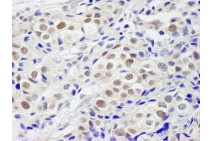 anti-PHD Finger Protein 6 (PHF6) (AA 125-175) antibody