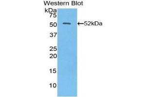 Detection of Recombinant IFNb, Human using Polyclonal Antibody to Interferon Beta (IFNb) (IFNB1 anticorps  (AA 22-187))