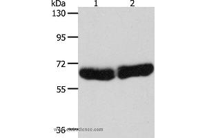Western blot analysis of Human fetal liver and brain tissue, using CYP1B1 Polyclonal Antibody at dilution of 1:250 (CYP1B1 anticorps)
