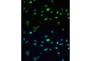 Immunofluorescence analysis of U-2 OS cells using MDC1 antibody (ABIN6131721, ABIN6143660, ABIN6143662 and ABIN6224387) at dilution of 1:100.