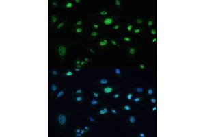 Immunofluorescence analysis of U-2 OS cells using MDC1 antibody (ABIN6131721, ABIN6143660, ABIN6143662 and ABIN6224387) at dilution of 1:100. (MDC1 anticorps  (AA 1-350))