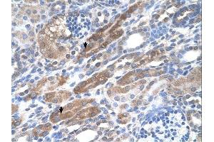 KIAA0319 antibody was used for immunohistochemistry at a concentration of 4-8 ug/ml.