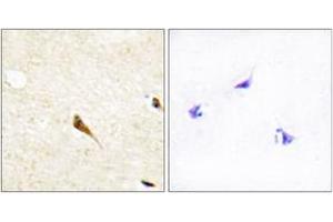 Immunohistochemistry analysis of paraffin-embedded human brain tissue, using MOK Antibody.