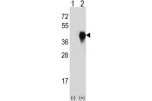 Western Blotting (WB) image for anti-Plasminogen Activator, Urokinase Receptor (PLAUR) antibody (ABIN3003728) (PLAUR anticorps)