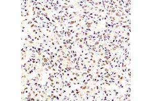 Immunohistochemistry of paraffin embedded mouse thymus using ZC3H11A (ABIN7076255) at dilution of 1: 6000 (400x lens)