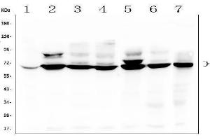 Western blot analysis of TDRD3 using anti-TDRD3 antibody (ABIN6719636).