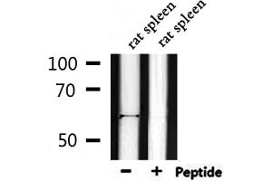 Western blot analysis of extracts from rat spleen, using Phospho-Akt1 (Thr450) Antibody.