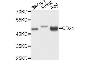 Western blot analysis of extracts of various cells, using CD24 antibody. (CD24 anticorps)