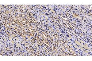 Detection of ALT in Rat Kidney Tissue using Polyclonal Antibody to Alanine Aminotransferase (ALT)