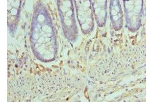 Immunohistochemistry of paraffin-embedded human colon tissue using ABIN7145996 at dilution of 1:100