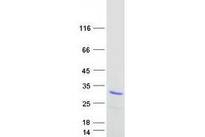 Validation with Western Blot