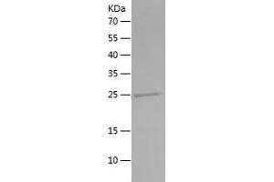 Western Blotting (WB) image for Secreted phosphoprotein 1 (SPP1) (AA 28-61) protein (His-IF2DI Tag) (ABIN7125002)