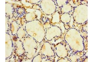 Immunohistochemistry of paraffin-embedded human thyroid tissue using ABIN7155301 at dilution of 1:100 (HDAC1 anticorps  (AA 1-482))