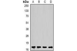 Western blot analysis of Cofilin 2 expression in Hela (A), mouse heart (B), rat kidney (C), rat brain (D) whole cell lysates. (Cofilin 2 anticorps)