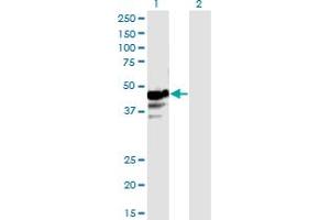 Western Blot analysis of NAPRT1 expression in transfected 293T cell line by NAPRT1 monoclonal antibody (M01), clone 4A9. (NAPRT1 anticorps  (AA 1-466))