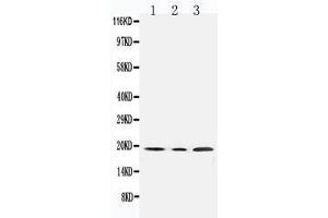 Anti-SDHC antibody, Western blottingAll lanes: Anti SDHC  at 0.
