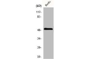 Western Blot analysis of HuvEc cells using IP3KA Polyclonal Antibody (ITPKA anticorps  (C-Term))
