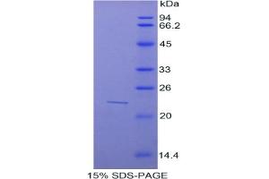 SDS-PAGE of Protein Standard from the Kit (Highly purified E. (SUOX Kit ELISA)