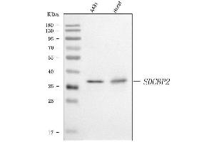 Western blot analysis of Syntenin 2/SDCBP2 using anti-Syntenin 2/SDCBP2 antibody (ABIN7600017).