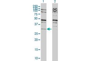 Western Blot analysis of TP53RK expression in transfected 293T cell line by TP53RK monoclonal antibody (M01), clone 4B9-1H3. (TP53RK anticorps  (AA 1-253))