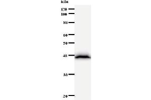 Western Blotting (WB) image for anti-Bromodomain Adjacent To Zinc Finger Domain, 1B (BAZ1B) antibody (ABIN930943) (BAZ1B anticorps)