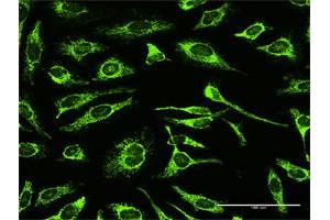 Immunofluorescence of purified MaxPab antibody to TRAP1 on HeLa cell.