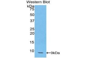 Western blot analysis of the recombinant protein. (CCL14 anticorps  (AA 20-93))