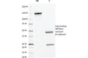 SDS-PAGE Analysis Purified c-Myc Mouse Monoclonal Antibody (9E10. (Myc Tag anticorps  (C-Term))