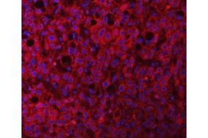 IF analysis of RAB3GAP1 using anti-RAB3GAP1 antibody (ABIN7599702). (RAB3GAP1 anticorps  (AA 109-810))