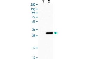Western blot analysis of Lane 1: Human cell line RT-4 Lane 2: Human cell line U-251MG sp with RPL8 polyclonal antibody  at 1:500-1:1000 dilution. (RPL8 anticorps)