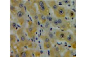 Used in DAB staining on fromalin fixed paraffin-embedded Liver tissue (CENPE anticorps  (AA 2450-2590))