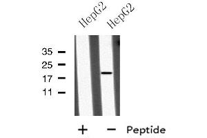 Western blot analysis of MID1IP1 using HepG2 whole cell lysates (m1ip1 anticorps  (Internal Region))