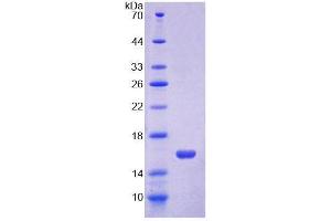 SDS-PAGE analysis of Mouse Occludin Protein.
