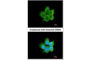 ICC/IF Image Immunofluorescence analysis of paraformaldehyde-fixed A431, using CacyBP, antibody at 1:200 dilution. (CACYBP anticorps)