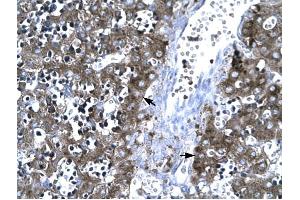 MMP19 antibody was used for immunohistochemistry at a concentration of 4-8 ug/ml to stain Hepatocytes (arrows) in Human Liver. (MMP19 anticorps  (C-Term))
