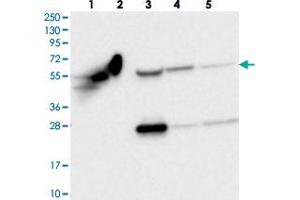 Western blot analysis of Lane 1: RT-4, Lane 2: U-251 MG, Lane 3: Human Plasma, Lane 4: Liver, Lane 5: Tonsil with OTUD1 polyclonal antibody  at 1:250-1:500 dilution. (OTUD1 anticorps)
