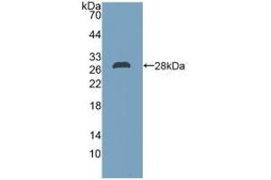 Detection of Recombinant DDAH2, Human using Polyclonal Antibody to Dimethylarginine Dimethylaminohydrolase 2 (DDAH2) (DDAH2 anticorps  (AA 31-265))