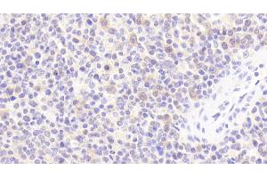 Detection of IL1RA in Human Spleen Tissue using Polyclonal Antibody to Interleukin 1 Receptor Antagonist (IL1RA)