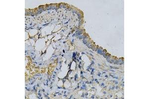 Immunohistochemistry of paraffin-embedded mouse lung using APRT Antibody. (APRT anticorps  (AA 1-180))
