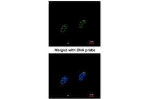 ICC/IF Image Immunofluorescence analysis of paraformaldehyde-fixed HeLa, using RPA 70 kDa subunit , antibody at 1:200 dilution.