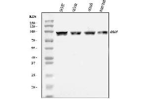 Western blot analysis of B Raf/BRAF using anti-B Raf/BRAF antibody (ABIN3043761). (BRAF anticorps  (AA 38-230))