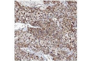IHC analysis of VAPB using anti-VAPB antibody (ABIN5693292). (VAPB anticorps  (AA 2-55))