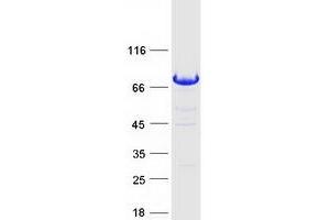 Validation with Western Blot