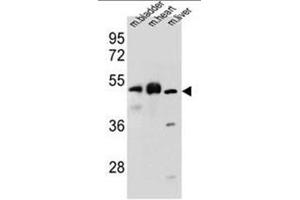 BTBD17 Antibody (C-term) western blot analysis in mouse bladder,heart,liver tissue lysates (35µg/lane). (BTBD17 anticorps  (C-Term))