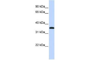 WB Suggested Anti-VGLL3 Antibody Titration: 0. (VGLL3 anticorps  (Middle Region))