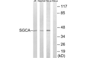 Western Blotting (WB) image for anti-Sarcoglycan, alpha (50kDa Dystrophin-Associated Glycoprotein) (SGCA) (Internal Region) antibody (ABIN1850734) (SGCA anticorps  (Internal Region))