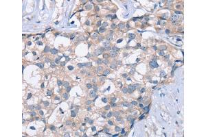 Immunohistochemistry (IHC) image for anti-Potassium Voltage-Gated Channel, KQT-Like Subfamily, Member 5 (KCNQ5) antibody (ABIN2423696) (KCNQ5 anticorps)
