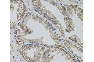 Immunohistochemistry of paraffin-embedded Human prostate using VIP Polyclonal Antibody (Vip anticorps)